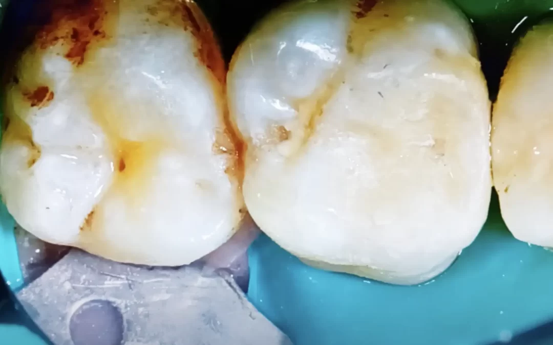 intarsio in ceramica