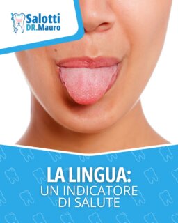 👅 La lingua può rivelare molto sullo stato della tua salute orale e generale.
Una lingua patinata, secca o irritata va controllata!

#prevenzione #saluteorale