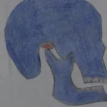 Apertura della bocca sue complicanze