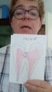 🦷 Mal di denti: da cosa può dipendere?
Un dolore a un dente può avere origini molto diverse e non sempre la causa è immediatamente evidente.
🎥 Nel video completo su YouTube, il Dott. Mauro Salotti analizza in maniera semplice e chiara le principali possibili cause alla base del classico mal di denti, distinguendo tra:
🔹 cause infettive
🔹 cause infiammatorie
🔹 cause traumatiche
Capire da dove nasce il dolore è fondamentale per poter individuare il trattamento più adeguato.
👉 Guarda il video completo sul nostro canale YouTube e scopri quali possono essere le diverse origini del mal di denti e perché è importante non sottovalutarlo.
📩 Se il dolore persiste o compare improvvisamente, è importante sottoporsi a una valutazione odontoiatrica.
#maldidenti #malditdente #doloredentale #saluteorale #odontoiatria #dentista #prevenzione #infiammazione #infezionidentali #traumadentale #denti #sanbenedettodeltronto